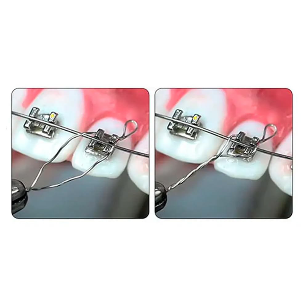 Orthodontic Kobayashi Tie Hooks Longs (Ø .010″ / .012″ / .014″) Designed for simple placement and compatibility - Pack of 100 Made in USA Orthodentalusa Corp. Free Shipping