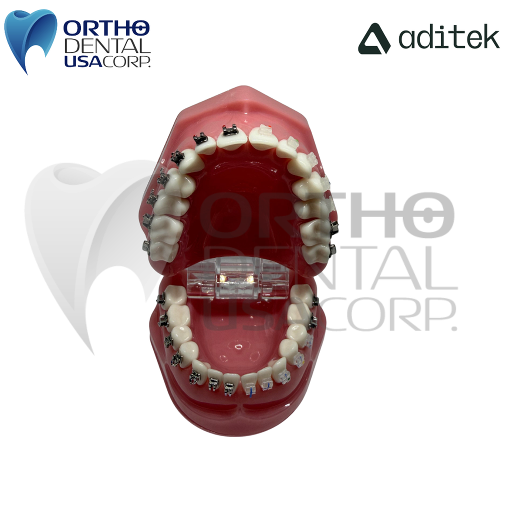 Model for Study with self ligating Brackets 7×7 EasyClip+ Passive 022 MBT Hk 3,4,5 w/28 pcs Vector+, BioMax, Ceramic Translux, Sapphire Aditek 00.02.0005