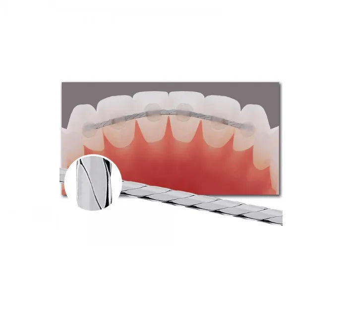 Flat Lingual RETAINER SS Braid Wire Size .010″ x .028″ 6 inch (152mm) lengths PACK x 10