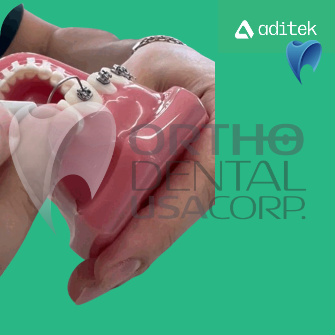 Model for Study with self ligating Brackets 7×7 EasyClip+ Passive 022 MBT Hk 3,4,5 w/28 pcs Vector+, BioMax, Ceramic Translux, Sapphire Aditek 00.02.0005