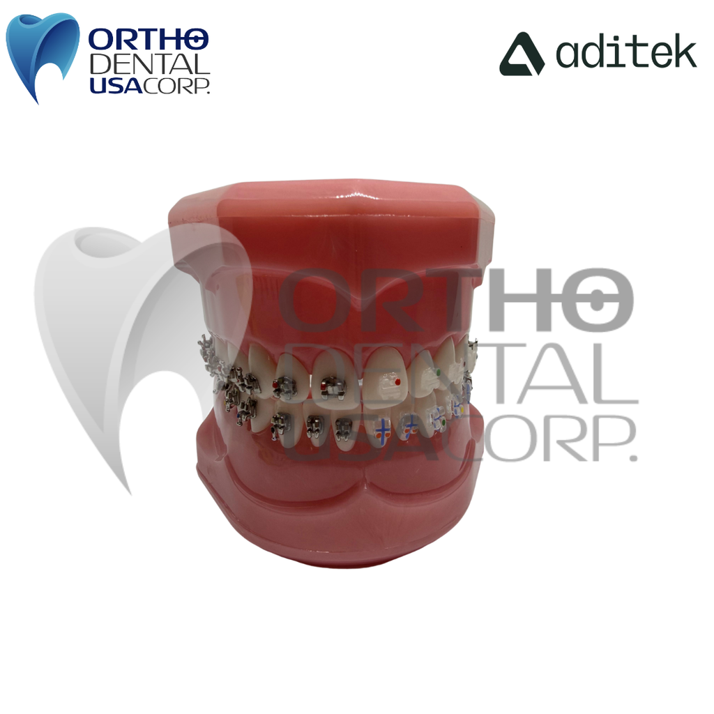 Model for Study with self ligating Brackets 7×7 EasyClip+ Passive 022 MBT Hk 3,4,5 w/28 pcs Vector+, BioMax, Ceramic Translux, Sapphire Aditek 00.02.0005