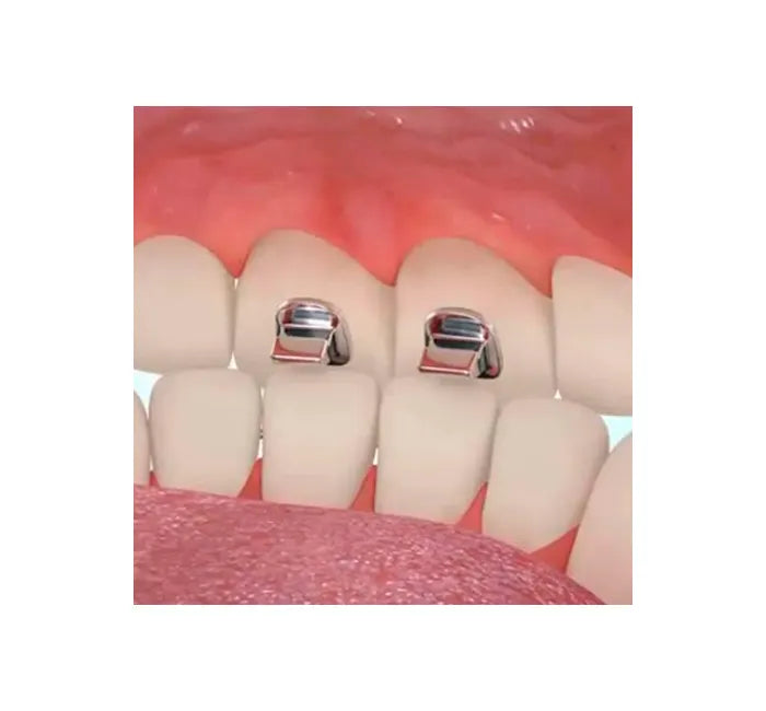 Bite Turbo Stop and Bite Guide 10 pcs