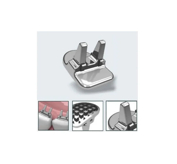 Tongue Tramers / Lingual Spur Mini Educator / Control de Habito / Set ...