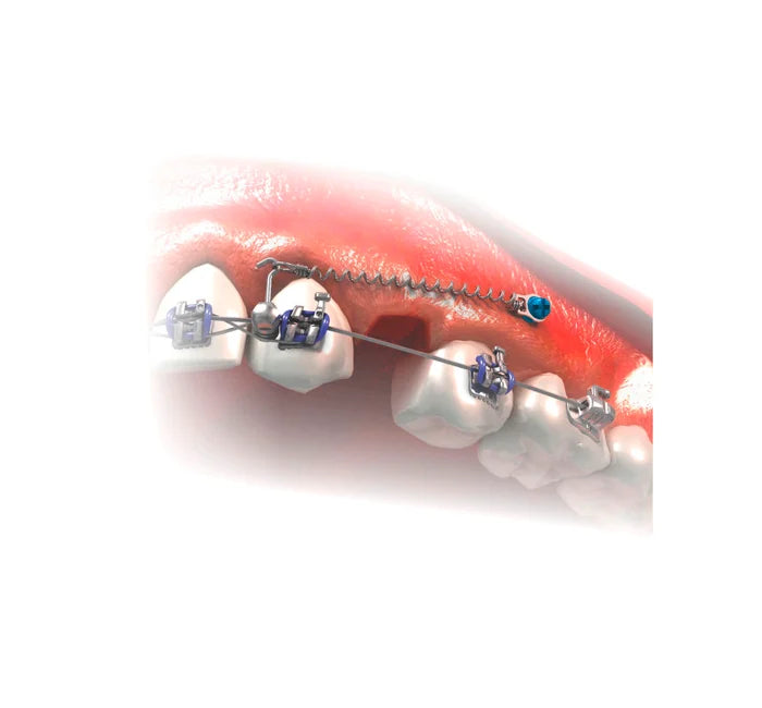 TADS Mini Screw with Bracket Head Counter clockwise