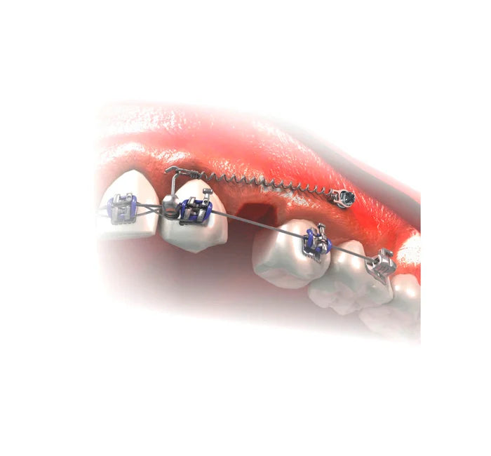 TADS Mini Screw with Bracket Head Clockwise - 1PCS