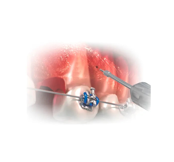 Hexagonal Key Long Stem - 1PC