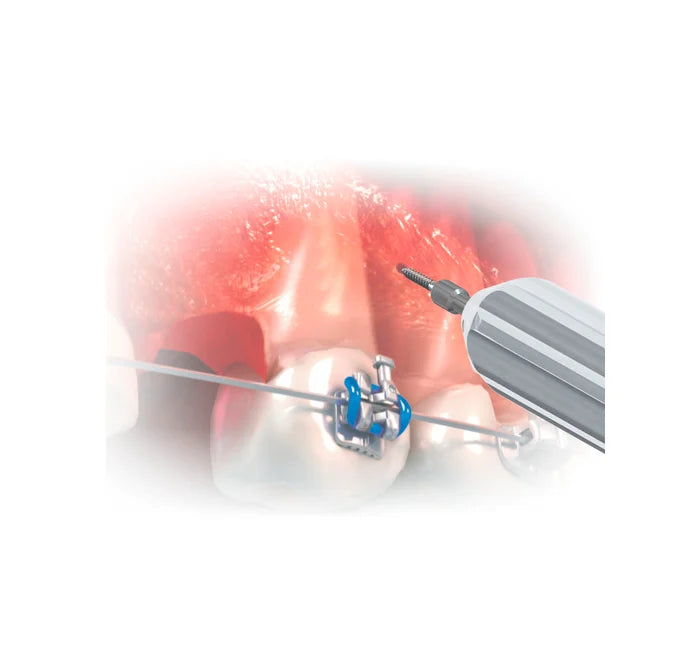 Hexagonal Key Short Stem