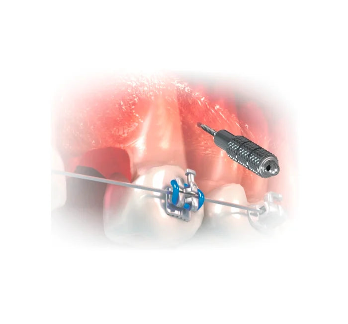 Hexagonal Digital Key - 1PC