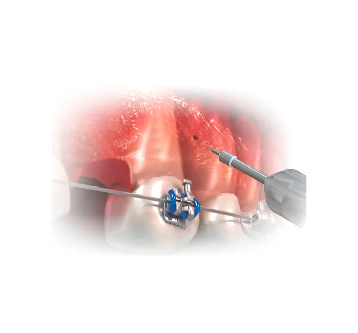 Hexagonal Key Medium Stem - 1PC