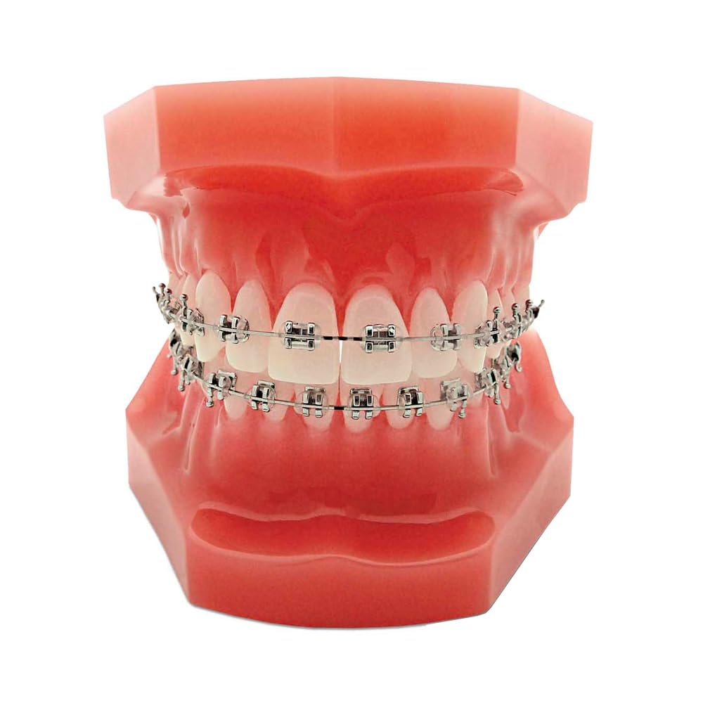 STAL Case 20 pcs METALLIC BRACKET Mini Roth/MBT .018"/.022" – W/H 3,4,5 / MESH Base Free Shipping