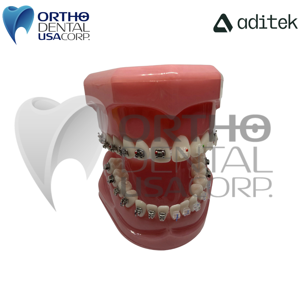 Model for Study with self ligating Brackets 7×7 EasyClip+ Passive 022 MBT Hk 3,4,5 w/28 pcs Vector+, BioMax, Ceramic Translux, Sapphire Aditek 00.02.0005