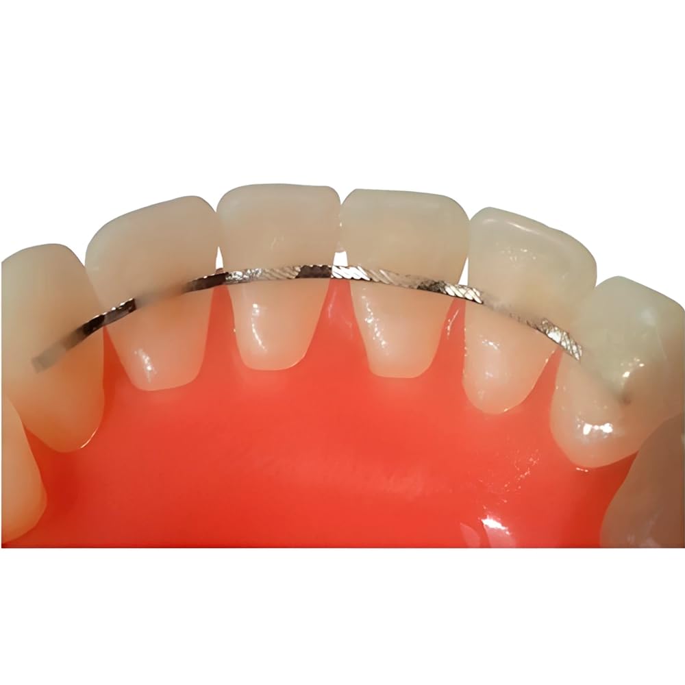 SSR  Flat Lingual Retainer Stainless Steel Braid Wire Easy to Adapt and Prevents inadvertent Tooth Movement Size .010" x .028" Made in USA Orthodentalusa Corp. (Stainless Steel Braid Wire) Free Shipping