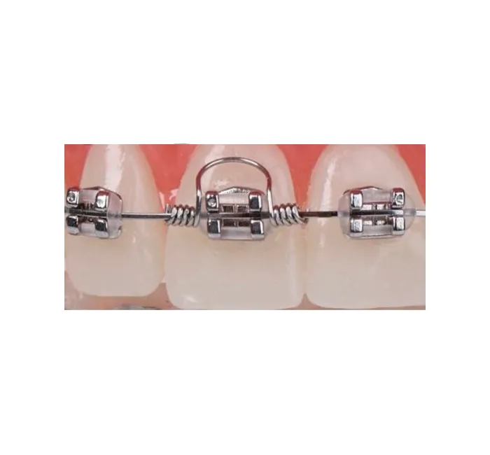 Orthodontic Torquing Coil Springs 10 pcs