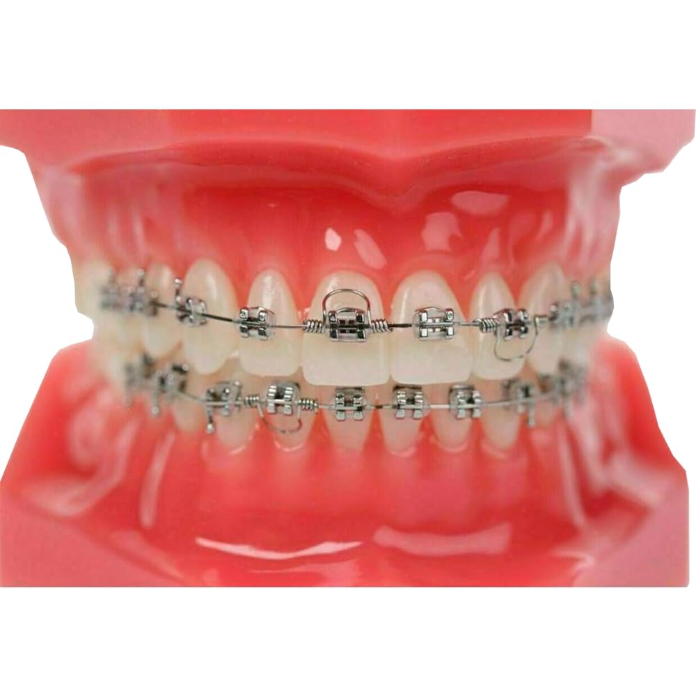 Orthodontic Torquing Coil Springs for Fine Adjustments designed to apply controlled rotational to teeth forces - 10 pcs Made in USA Orthodentalusa Corp Free Shipping