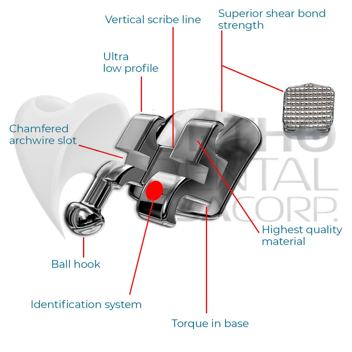 KIT Include Brackets Elastomeric Ligature Ties and bag of Wires Orthodentalusa