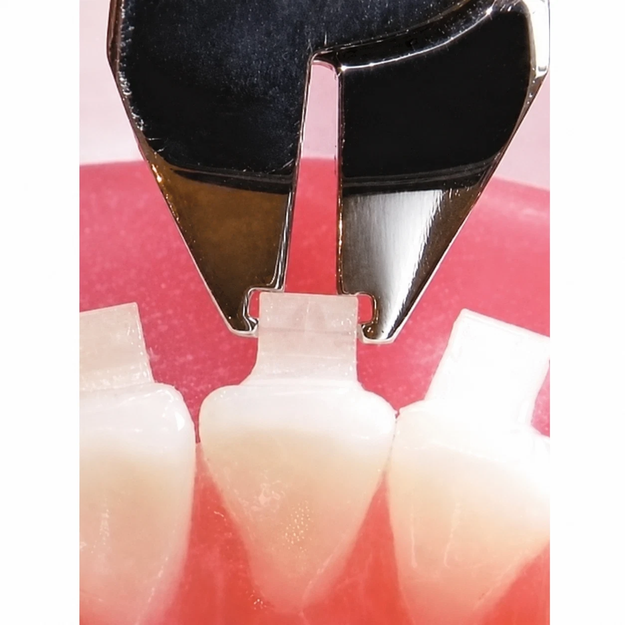 Ceramic Bracket Remover Pliers Straight or Angled Orthodontic N21150875/ 0876
