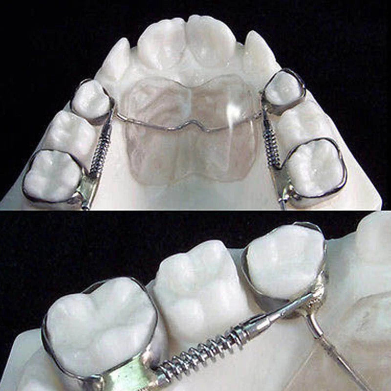 Dental Orthodontic Appliance Spring Molar Pusher Distalizer Expansion Spring with Lingual Sheats Ref:&nbsp; Vip-EMPRC